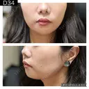 糸リフト PRISM Beauty Clinic 町田院 DAY 34 サムネイル用