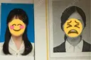 ボトックス（エラ・小顔） 共立美容外科 大阪本院 DAY 1 サムネイル用