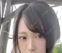 クマ治療 / 下まぶたたるみ取り / ボトックス（あご） / ヒアルロン酸注入（あご） / ヒアルロン酸注入（目の下） / ヒアルロン酸注入（鼻翼基部） / スネコス Tokyo Tensei Clinic 新宿院 DAY 15 サムネイル用