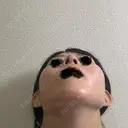 隆鼻術 / 鼻中隔延長（切開） / 鼻翼基部形成（貴族手術） ヴェリテクリニック 銀座院 DAY 264 サムネイル用