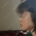 ヒアルロン酸注入（あご） ヴェリテクリニック 大阪院 DAY 1 サムネイル用