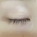 その他（目元） グリシーヌクリニック DAY 11 サムネイル用