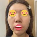 ポテンツァ DAILY SKIN CLINIC 福岡院 DAY 4 サムネイル用