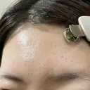 ポテンツァ DAILY SKIN CLINIC 福岡院 DAY 4 サムネイル用