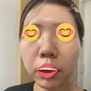 ポテンツァ DAILY SKIN CLINIC 福岡院 DAY 6 サムネイル用