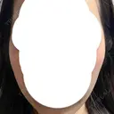 糸リフト 福岡TAクリニック AFTER サムネイル用