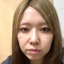 隆鼻術 / 鼻尖形成（切開） / 鼻中隔延長（切開） / 軟骨移植 WOM CLINIC GINZA （ワム クリニック ギンザ） DAY 91 サムネイル用