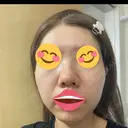 ポテンツァ DAILY SKIN CLINIC 福岡院 AFTER サムネイル用