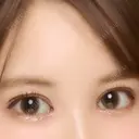 二重切開 / 目頭切開 / 眼瞼下垂（切開） / その他（目元） / 上まぶたの脂肪取り レアート整形外科 DAY 29 サムネイル用