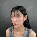 二重埋没 / 目頭切開 / 糸リフト / 脂肪吸引（顔） / ヒアルロン酸注入（涙袋） / ヒアルロン酸注入（あご） / ボトックス（エラ・小顔） / ボトックス（人中） ネビュラクリニック 京都院 DAY 0 サムネイル用