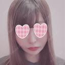 バッカルファット除去 / 脂肪吸引（顔） / ボトックス（あご） / ヒアルロン酸注入（あご） / ボトックス（エラ・小顔） / ヒアルロン酸注入（唇） / ボトックス（口角） エートップ美容整形外科 AFTER サムネイル用