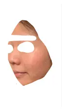 フラクショナルレーザー（毛穴・ニキビ跡） しらゆりメディカルクリニック （旧しらゆりビューティークリニック） DAY 6 サムネイル用