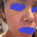 ポテンツァ NARU Beauty Clinic 【ナルクリ】 DAY 1 サムネイル用