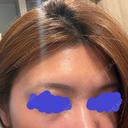 ポテンツァ NARU Beauty Clinic 【ナルクリ】 DAY 15 サムネイル用