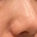 ポテンツァ 9BeautyClinic AFTER サムネイル用