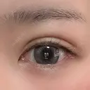 二重埋没 / ヒアルロン酸注入（涙袋） LOCHIC CLINIC GINZA【ロシッククリニック銀座】 DAY 18 サムネイル用