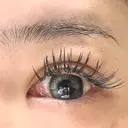 二重埋没 / ヒアルロン酸注入（涙袋） LOCHIC CLINIC GINZA【ロシッククリニック銀座】 AFTER サムネイル用