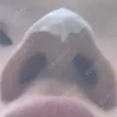 隆鼻術 / ヒアルロン酸注入（鼻） 渋谷美容外科クリニック 新宿院 DAY 0 サムネイル用