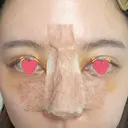 骨切幅寄せ 9BeautyClinic DAY 5 サムネイル用