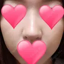 隆鼻術 / 鼻尖形成（切開） / 鼻中隔延長（切開） / 小鼻縮小（切開） / その他（鼻） / 骨切幅寄せ / 美容点滴・美容注射（美肌） FROM B整形外科 (旧バウム整形外科) AFTER サムネイル用