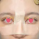 骨切幅寄せ 9BeautyClinic DAY 6 サムネイル用