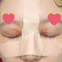 骨切幅寄せ 9BeautyClinic DAY 6 サムネイル用