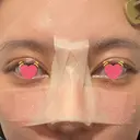 骨切幅寄せ 9BeautyClinic DAY 7 サムネイル用
