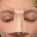 骨切幅寄せ 9BeautyClinic DAY 7 サムネイル用
