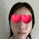 脂肪注入（輪郭） / PRP皮膚再生療法 EMMO FACE CLINIC 大宮院 DAY 1 サムネイル用
