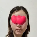 脂肪注入（輪郭） / PRP皮膚再生療法 EMMO FACE CLINIC 大宮院 DAY 8 サムネイル用