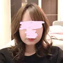 骨削り（頬） FROM B整形外科 (旧バウム整形外科) DAY 7 サムネイル用