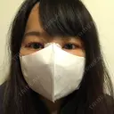 隆鼻術 / 鼻尖形成（切開） / 軟骨移植 / ワシ鼻修正・ハンプ切除 / 鼻尖縮小 表参道スキンクリニック 表参道院 DAY 3 サムネイル用