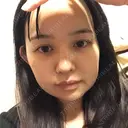 隆鼻術 / 鼻尖形成（切開） / 軟骨移植 / ワシ鼻修正・ハンプ切除 / 鼻尖縮小 表参道スキンクリニック 表参道院 AFTER サムネイル用