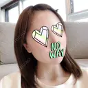 骨削り（頬） FROM B整形外科 (旧バウム整形外科) DAY 8 サムネイル用