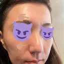 ポテンツァ 渋谷美容外科クリニック 横浜院 AFTER サムネイル用