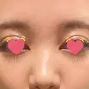 骨切幅寄せ 9BeautyClinic AFTER サムネイル用