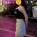 脂肪吸引（お腹） オアシス美容外科 DAY 252 サムネイル用