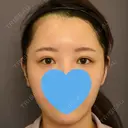 目頭切開 / 脂肪吸引（顔） / 目尻切開 / 脂肪注入（肌） / 脂肪注入（額） / 口角挙上 / メーラーファット除去 / タレ目形成・グラマラスライン（埋没） / 脂肪注入（輪郭） 札幌ル・トロワ ビューティクリニックVogue DAY 7 サムネイル用