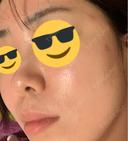 レーザーフェイシャル LIGHT CLINIC 【ライトクリニック】 新宿院 DAY 0 サムネイル用