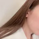 ボトックス（エラ・小顔） ミニマムスキンクリニック池袋 AFTER サムネイル用