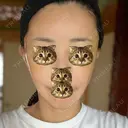 切開リフト 東京エビスクリニック DAY 7 サムネイル用