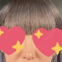 隆鼻術 / 鼻尖形成（切開） / 鼻中隔延長（切開） / 軟骨移植 R Beauty CLINIC 銀座院 DAY 7 サムネイル用