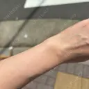 白玉点滴・注射 APOLLO BEAUTY CLINIC AFTER サムネイル用