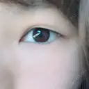 二重埋没 東京皮膚科・形成外科 (銀座いけだクリニック) AFTER サムネイル用