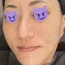 ポテンツァ 聖心美容クリニック 福岡院 AFTER サムネイル用