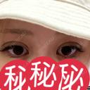 二重埋没 / ボトックス（エラ・小顔） 吉祥寺アイビークリニック DAY 1 サムネイル用