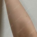 白玉点滴・注射 HAAB BEAUTY CLINIC 名古屋院 AFTER サムネイル用