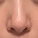 その他（肌） 代官山ウィメンズクリニック AFTER サムネイル用