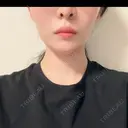 RF（高周波）たるみ治療 ルラ美容クリニック 渋谷本院 AFTER サムネイル用