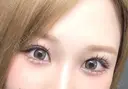 二重埋没 / ヒアルロン酸注入（涙袋） BELINDA CLINIC（ベリンダクリニック）新宿院 AFTER サムネイル用